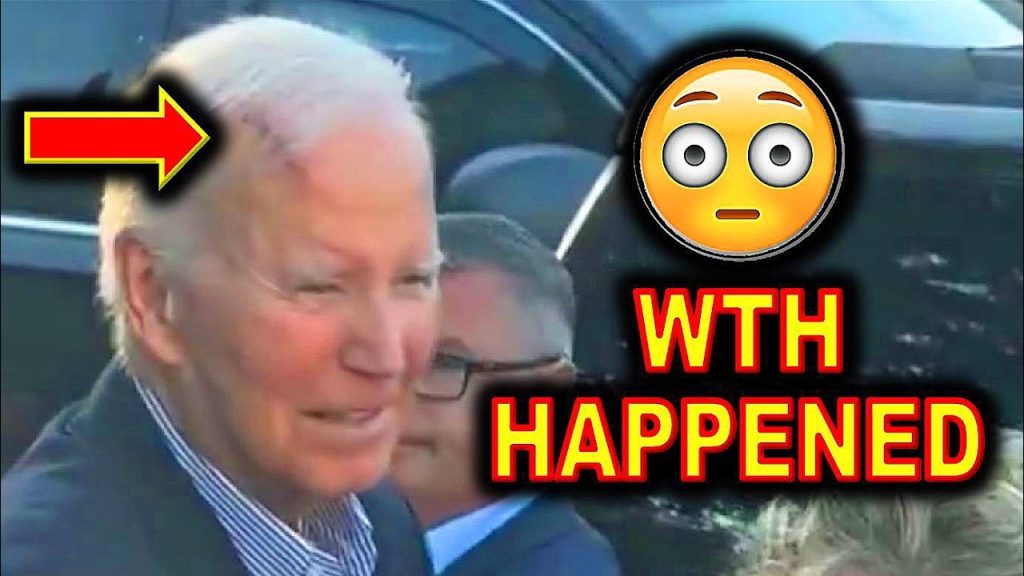 DISTURBING Clip of Joe Biden Released Yesterday with MASSIVE Injury…..